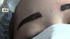 【独自】無資格「アートメイク」警察に相談を！厚労省が自治体に通知　美容後遺症外来の医師「医療の枠の中でやること大事」