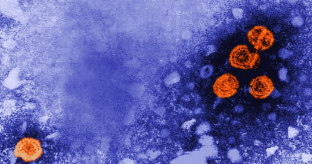 【ベピロビルセン】B型肝炎新薬で患者の約5人に1人が「機能的治癒」　RNA分解、日本で承認