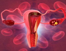 【欧州研究】子宮頸がん予防のワクチン接種を受けたデンマーク女性においてHPV16/18型がほぼ排除、ワクチン接種前の15〜17%から2021年には1%未満に減少