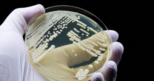 【性病】日本で発見の新種カンジダ 薬が効かず欧米で感染拡大